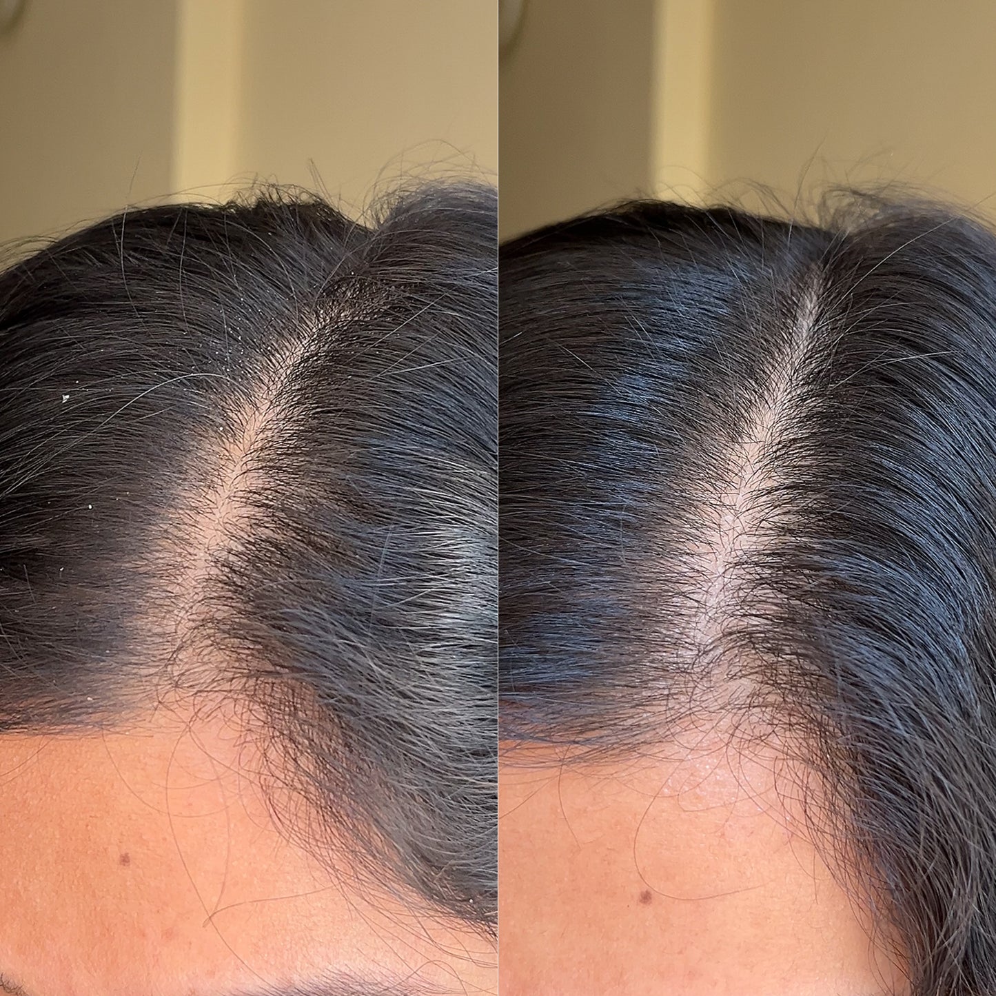 Anti-dandruff Coconut Shampoo