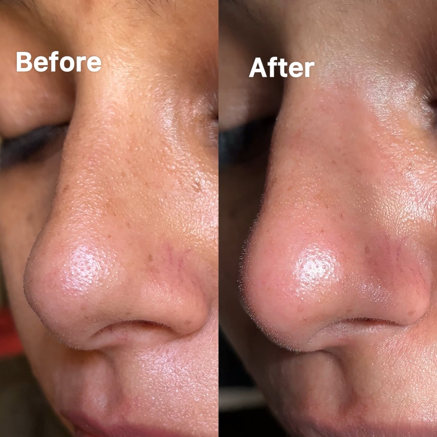 Activated Charcoal Peel Off