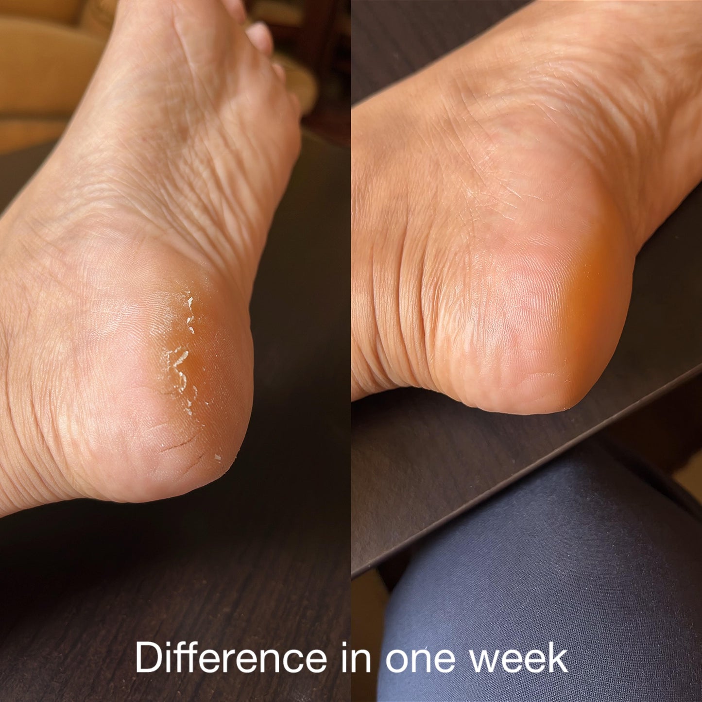 Kadam (Charan) Anti Crack Foot Cream